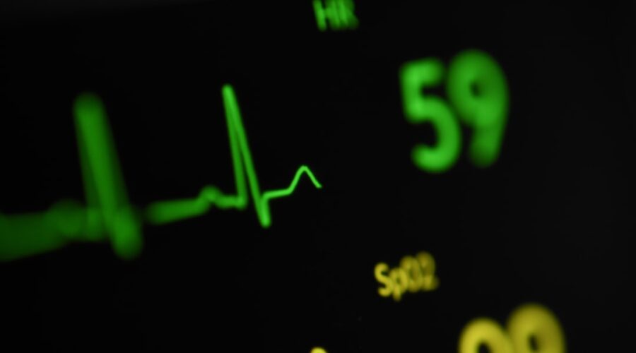 Photo ecg